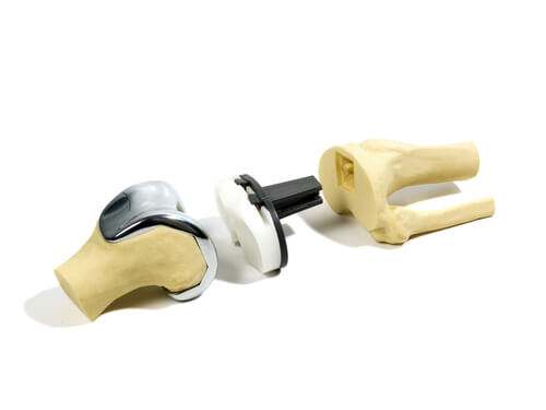 depuy high flex knees