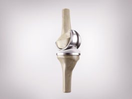 zimmer nexgen knee